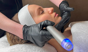 Unveiling the Potential of Your Skin with UltraFusion